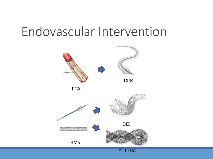 Updates on Endovascular Revascularization for Lower Limb Peripheral