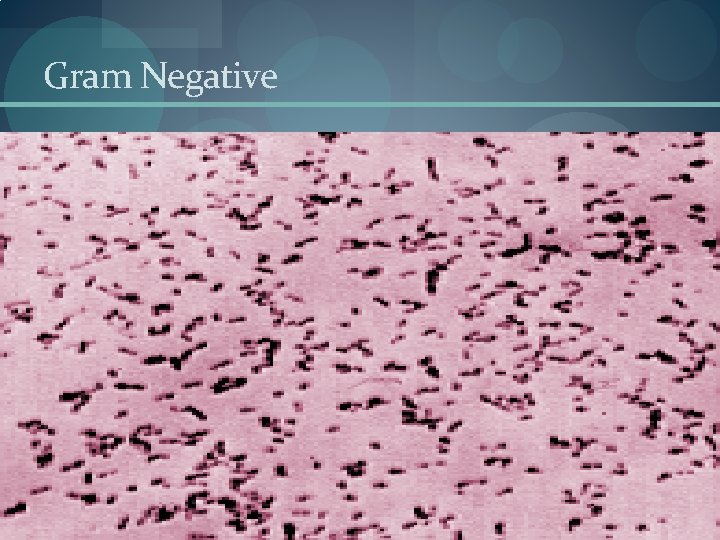 Gram Negative Gram Negative