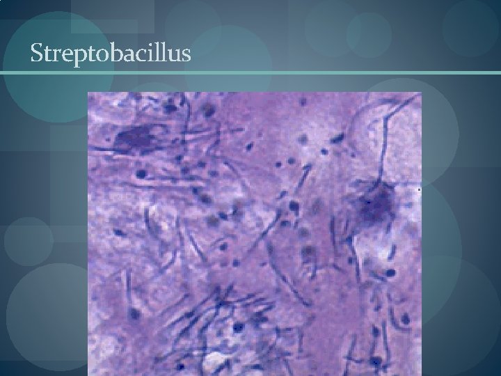 Streptobacillus Streptobacillus
