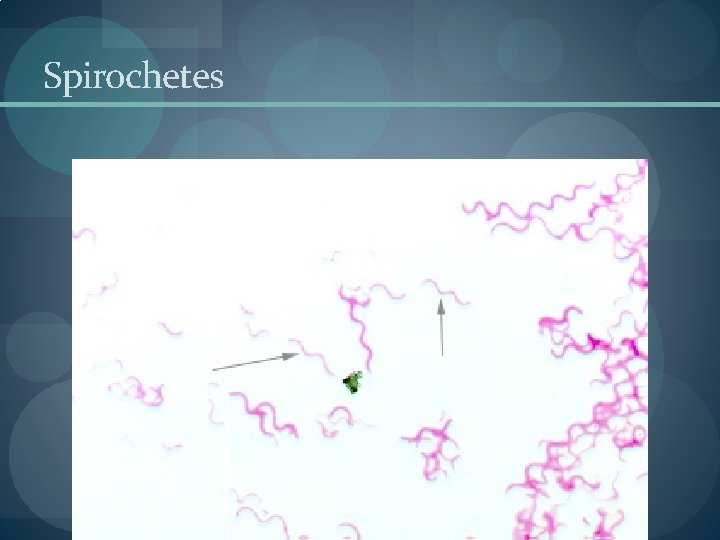 Spirochetes Spirochetes