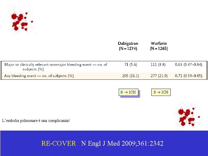 0 ICH 3 ICH L’embolia polmonare è una complicanza! RE-COVER N Engl J Med