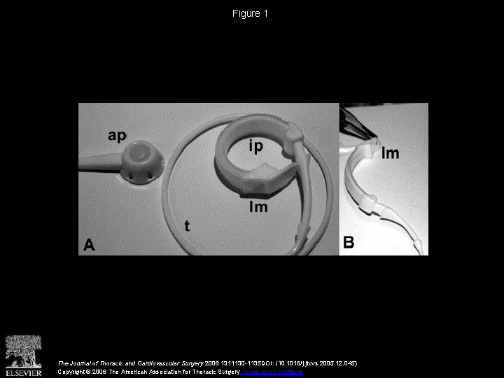 Figure 1 The Journal of Thoracic and Cardiovascular Surgery 2006 1311130 -1135 DOI: (10.