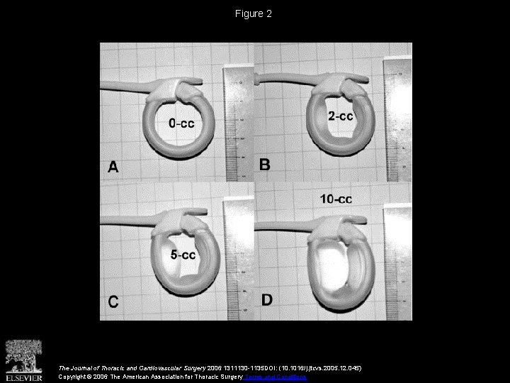 Figure 2 The Journal of Thoracic and Cardiovascular Surgery 2006 1311130 -1135 DOI: (10.