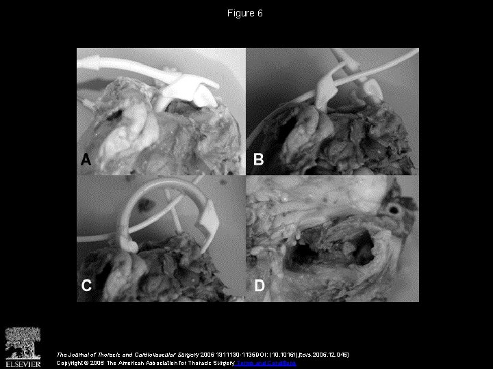 Figure 6 The Journal of Thoracic and Cardiovascular Surgery 2006 1311130 -1135 DOI: (10.