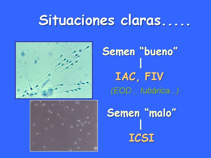 Situaciones claras. . . Semen “bueno” IAC, FIV (EOD , . tubárica. . .