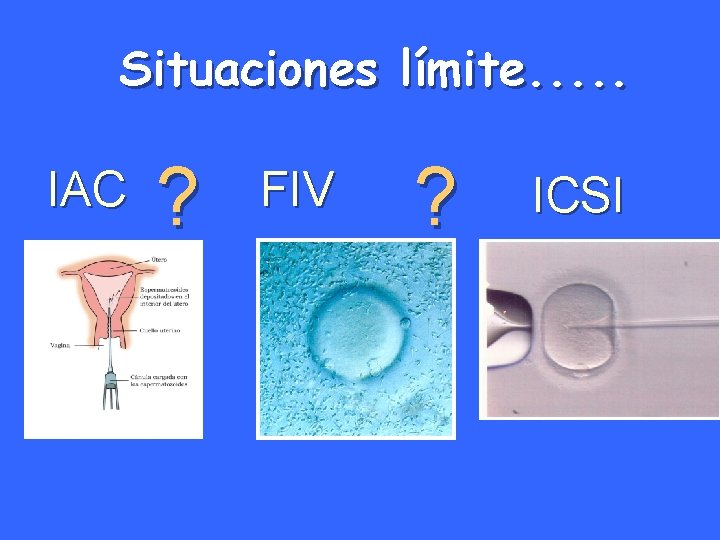 Situaciones límite. . . IAC ? FIV ? ICSI 