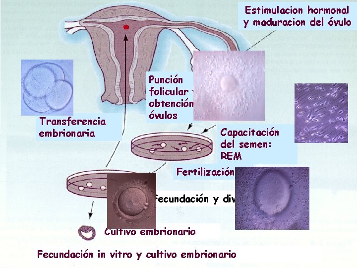 Estimulacion hormonal y maduracion del óvulo Transferencia embrionaria Punción folicular y obtención óvulos Capacitación