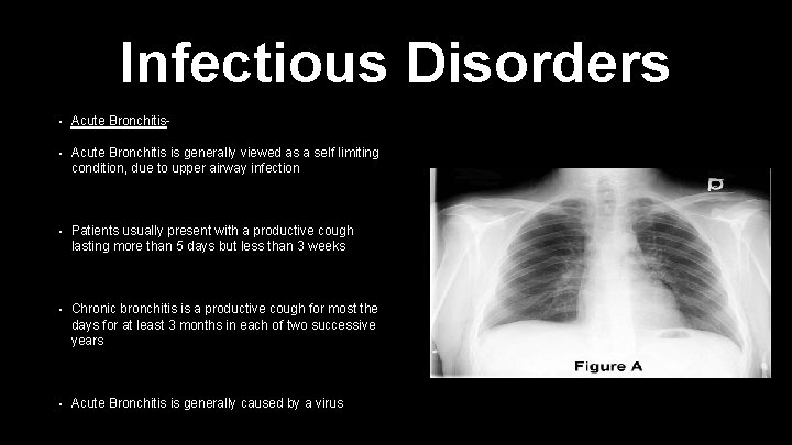 Infectious Disorders • Acute Bronchitis- • Acute Bronchitis is generally viewed as a self