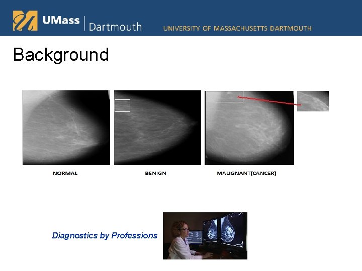 CrossDatabase Mammographic Image Analysis through Unsupervised Domain ...