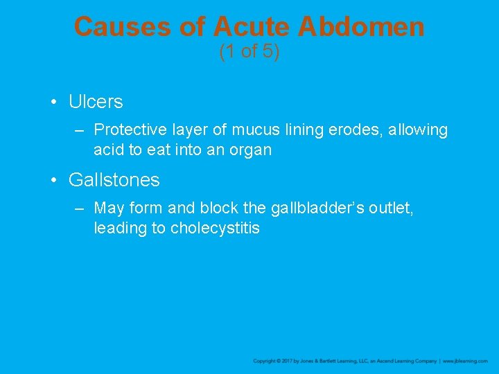 Causes of Acute Abdomen (1 of 5) • Ulcers – Protective layer of mucus