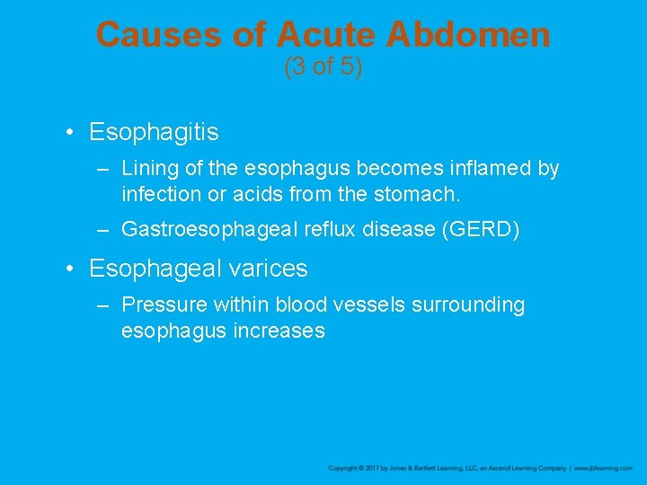 Causes of Acute Abdomen (3 of 5) • Esophagitis – Lining of the esophagus