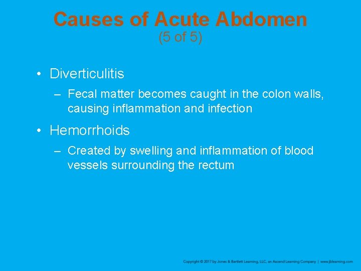 Causes of Acute Abdomen (5 of 5) • Diverticulitis – Fecal matter becomes caught