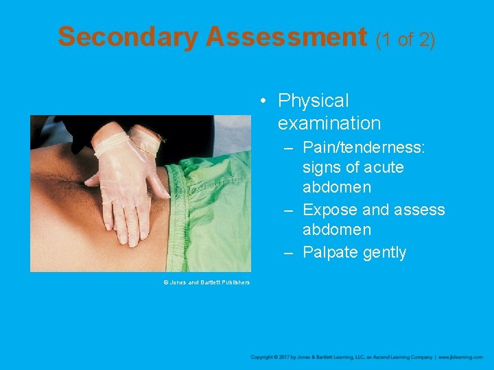 Secondary Assessment (1 of 2) • Physical examination – Pain/tenderness: signs of acute abdomen
