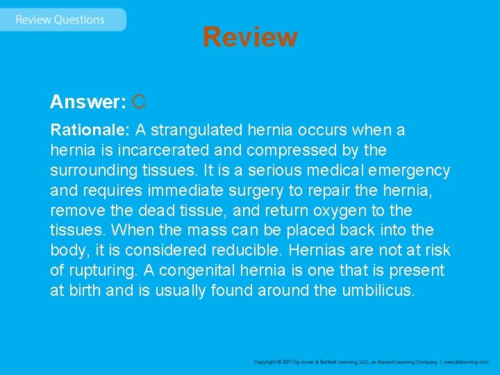 Review Answer: C Rationale: A strangulated hernia occurs when a hernia is incarcerated and