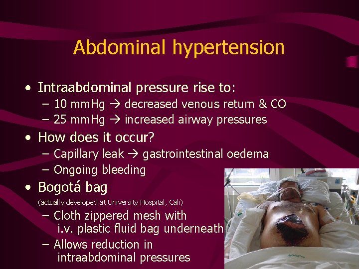 Abdominal hypertension • Intraabdominal pressure rise to: – 10 mm. Hg decreased venous return