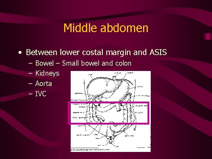 Middle abdomen • Between lower costal margin and ASIS – – Bowel – Small