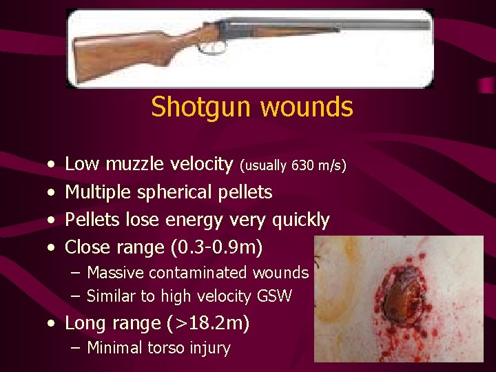 Shotgun wounds • • Low muzzle velocity (usually 630 m/s) Multiple spherical pellets Pellets