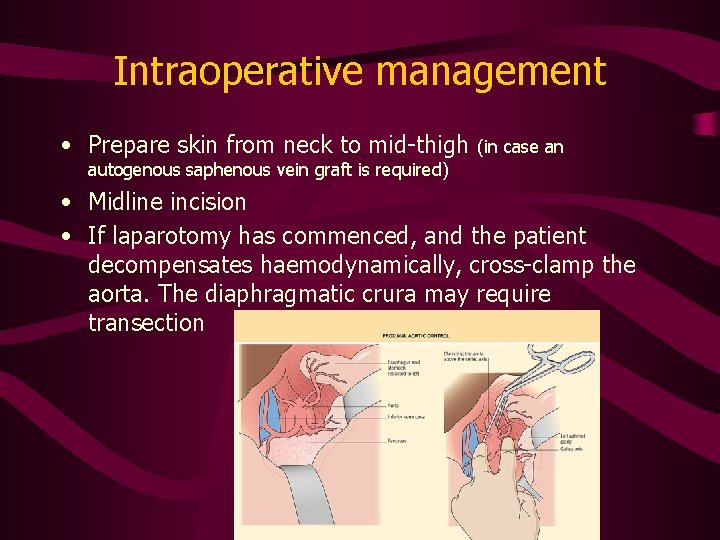 Intraoperative management • Prepare skin from neck to mid-thigh (in case an autogenous saphenous