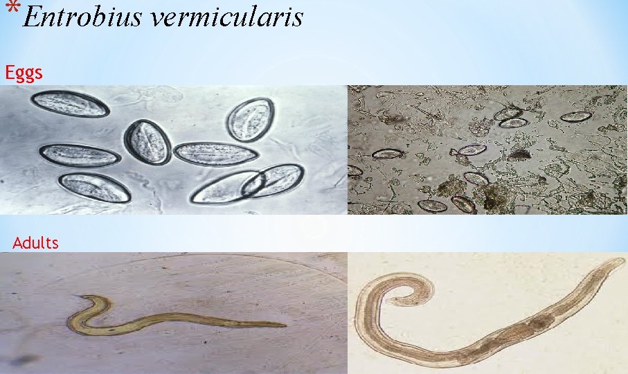 *Entrobius vermicularis Eggs Adults 