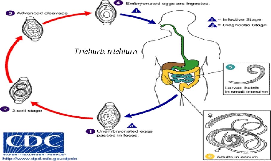 Trichuris trichiura 