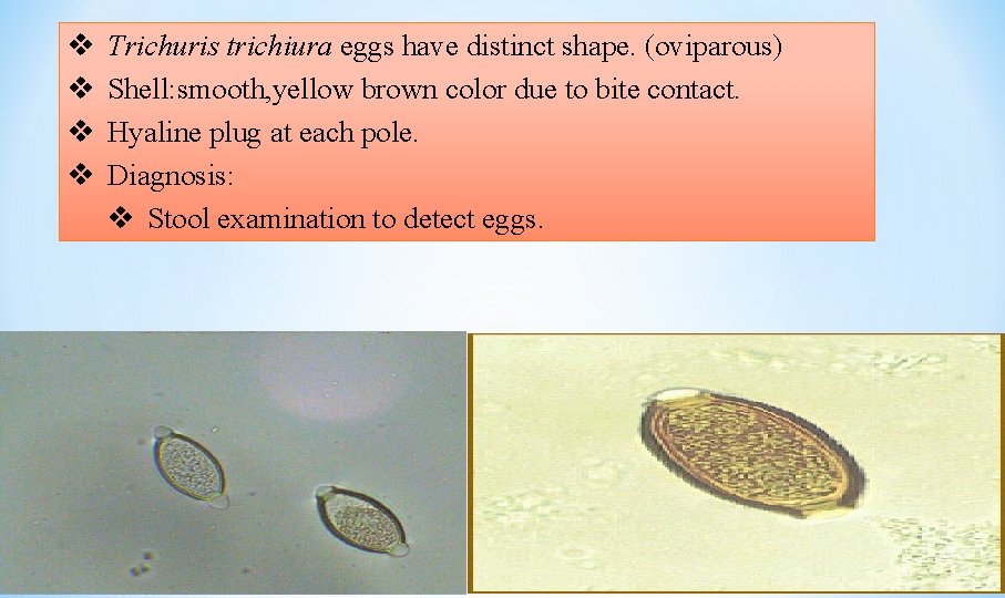 v v Trichuris trichiura eggs have distinct shape. (oviparous) Shell: smooth, yellow brown color