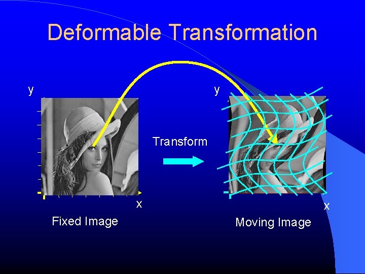 Deformable Transformation y y Transform x Fixed Image x Moving Image 