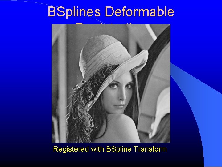 BSplines Deformable Registration Registered with BSpline Transform 