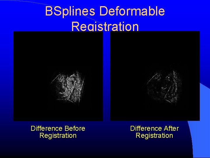 BSplines Deformable Registration Difference Before Registration Difference After Registration 