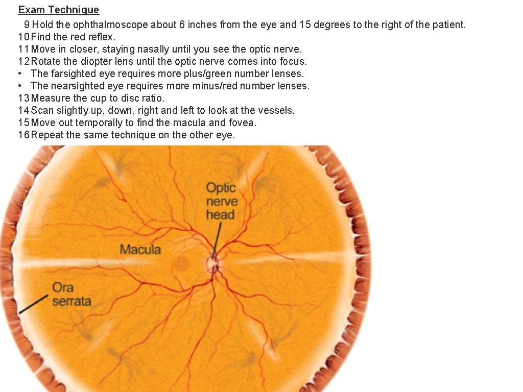 Exam Technique 9 Hold the ophthalmoscope about 6 inches from the eye and 15