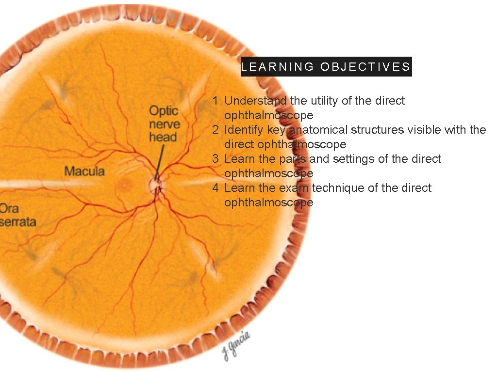 LEARNING OBJECTIVES 1 Understand the utility of the direct ophthalmoscope 2 Identify key anatomical