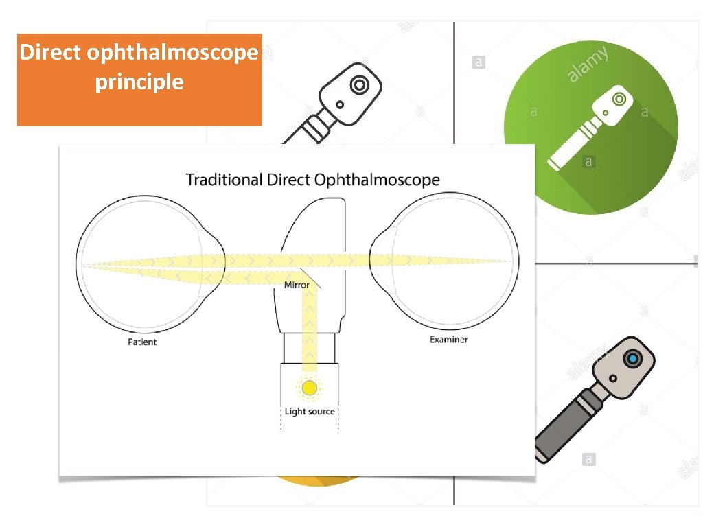 Direct ophthalmoscope principle “Type a quote here. ” –JOHNNY APPLESEED 