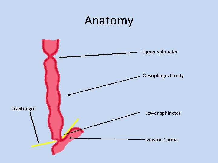 Anatomy Upper sphincter Oesophageal body Diaphragm Lower sphincter Gastric Cardia 