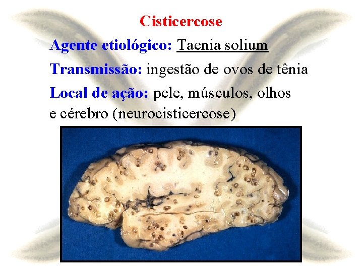 Cisticercose Agente etiológico: Taenia solium Transmissão: ingestão de ovos de tênia Local de ação: