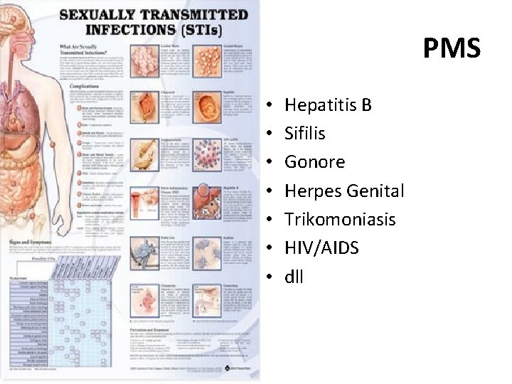 PMS • • Hepatitis B Sifilis Gonore Herpes Genital Trikomoniasis HIV/AIDS dll 