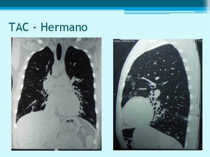 TAC - Hermano 