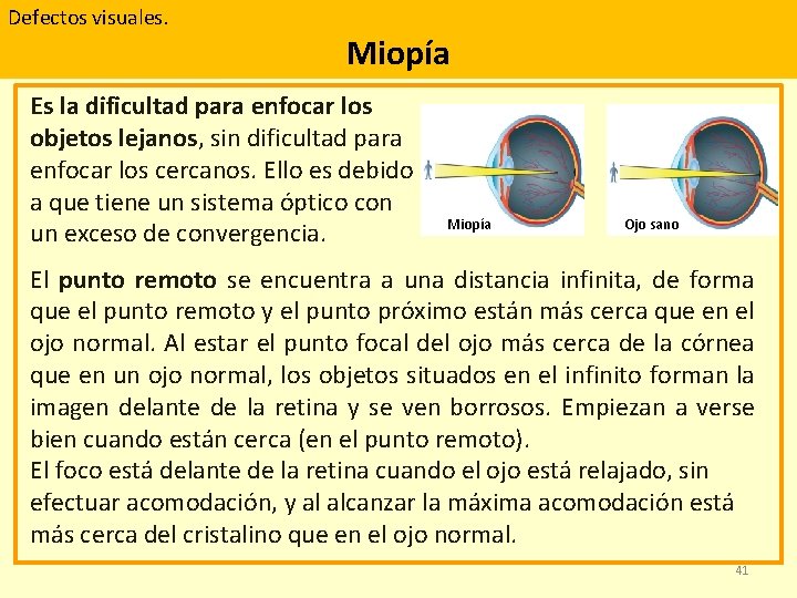 Defectos visuales. Miopía Es la dificultad para enfocar los objetos lejanos, sin dificultad para