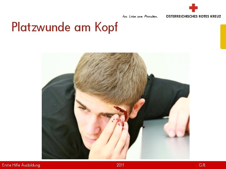 Platzwunde am Kopf Erste Hilfe. April Ausbildung Version | 2011 www. roteskreuz. at G.