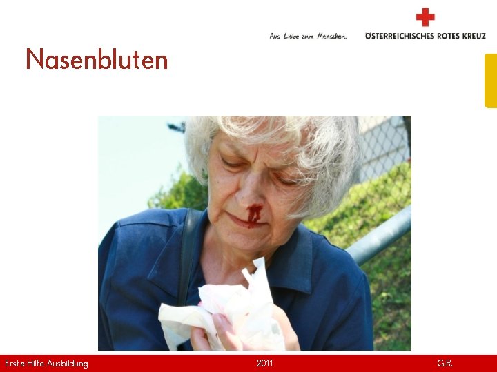 Nasenbluten Erste Hilfe. April Ausbildung Version | 2011 www. roteskreuz. at G. R. 43