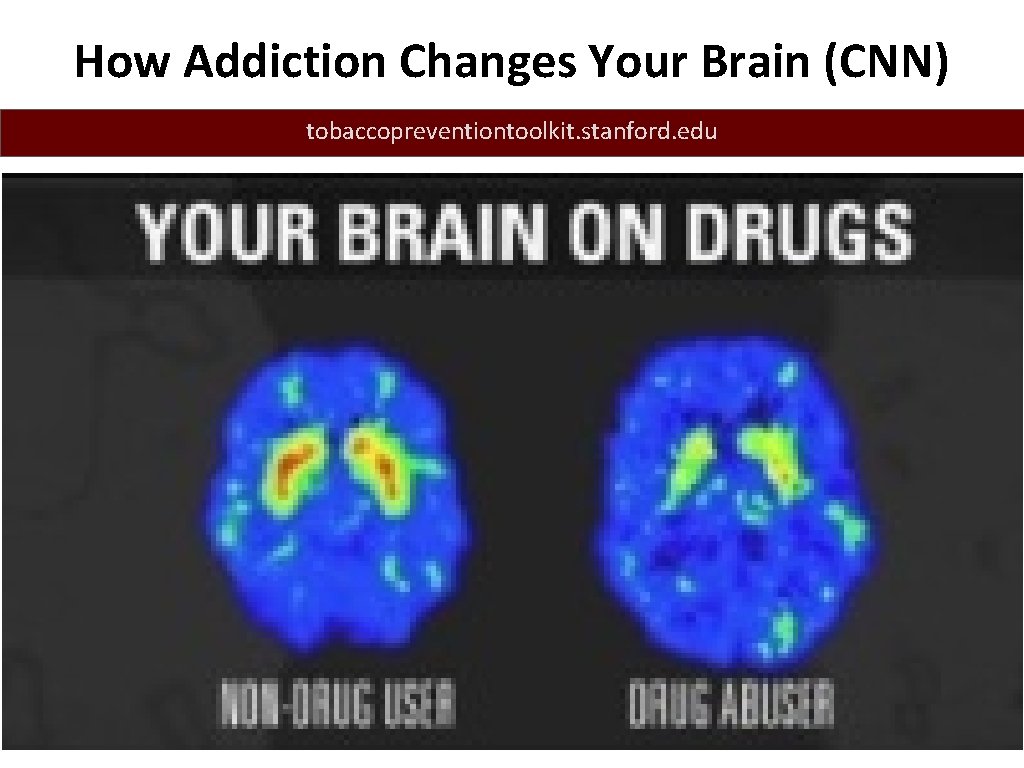 How Addiction Changes Your Brain (CNN) tobaccopreventiontoolkit. stanford. edu 