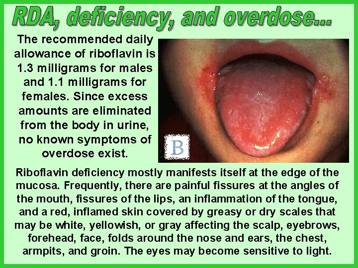 The recommended daily allowance of riboflavin is 1. 3 milligrams for males and 1.