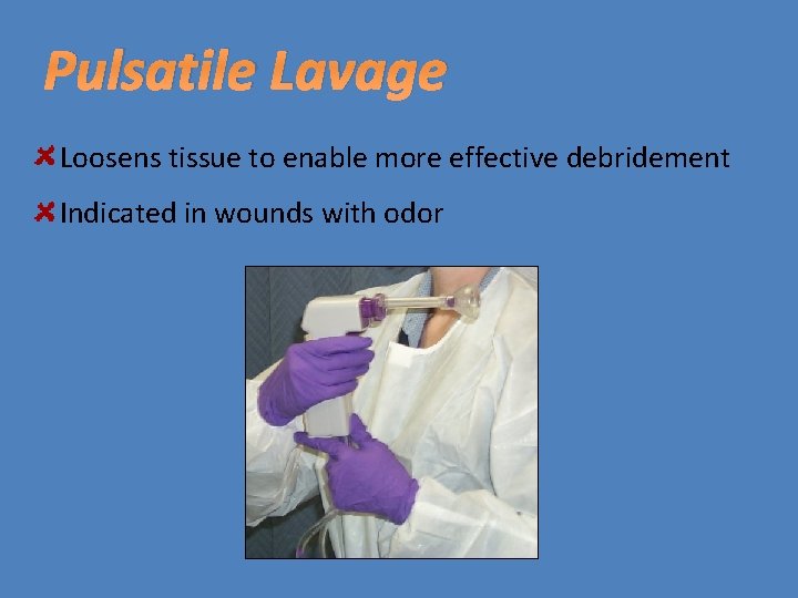 Pulsatile Lavage Loosens tissue to enable more effective debridement Indicated in wounds with odor