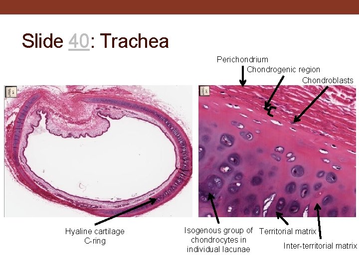 Slide 40: Trachea Perichondrium Chondrogenic region Chondroblasts Hyaline cartilage C-ring Isogenous group of Territorial