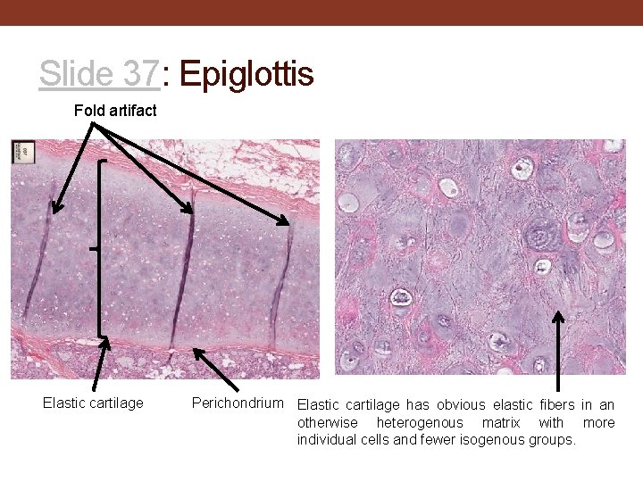 Slide 37: Epiglottis Fold artifact Elastic cartilage Perichondrium Elastic cartilage has obvious elastic fibers