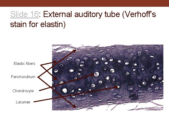 Slide 16: External auditory tube (Verhoff’s stain for elastin) Elastic fibers Perichondrium Chondrocyte Lacunae