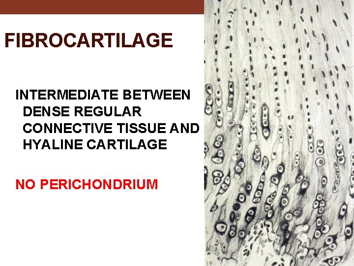 FIBROCARTILAGE INTERMEDIATE BETWEEN DENSE REGULAR CONNECTIVE TISSUE AND HYALINE CARTILAGE NO PERICHONDRIUM 