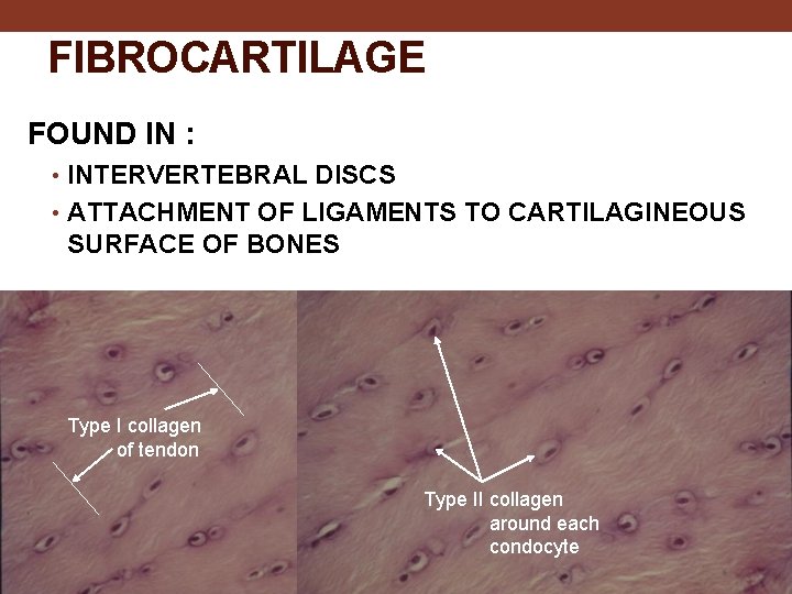 FIBROCARTILAGE FOUND IN : • INTERVERTEBRAL DISCS • ATTACHMENT OF LIGAMENTS TO CARTILAGINEOUS SURFACE