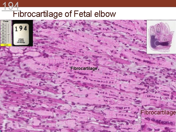 194 Fibrocartilage of Fetal elbow Fibrocartilage 