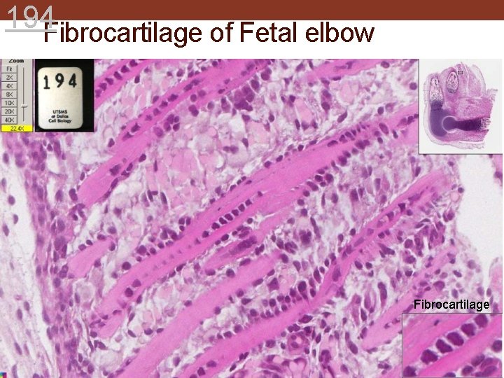 194 Fibrocartilage of Fetal elbow Fibrocartilage 