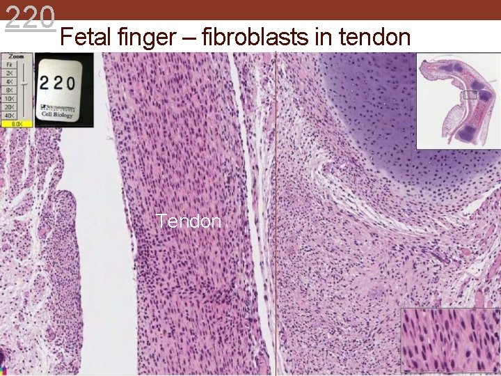 220 Fetal finger – fibroblasts in tendon Tendon 