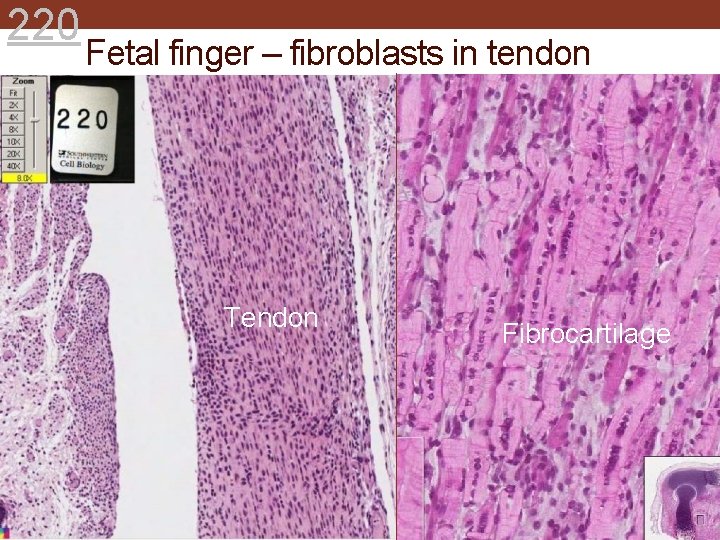 220 Fetal finger – fibroblasts in tendon Tendon Fibrocartilage 